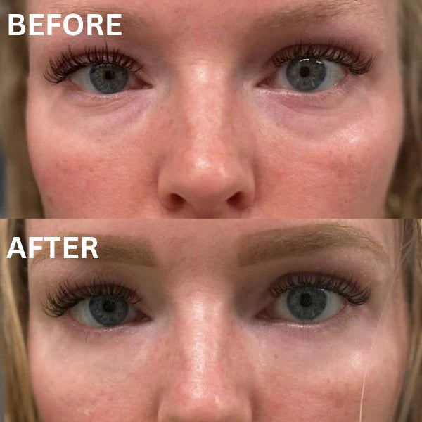 Revea™ Augen-Glow