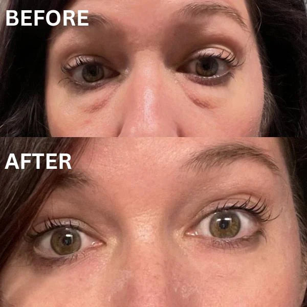Revea™ Augen-Glow