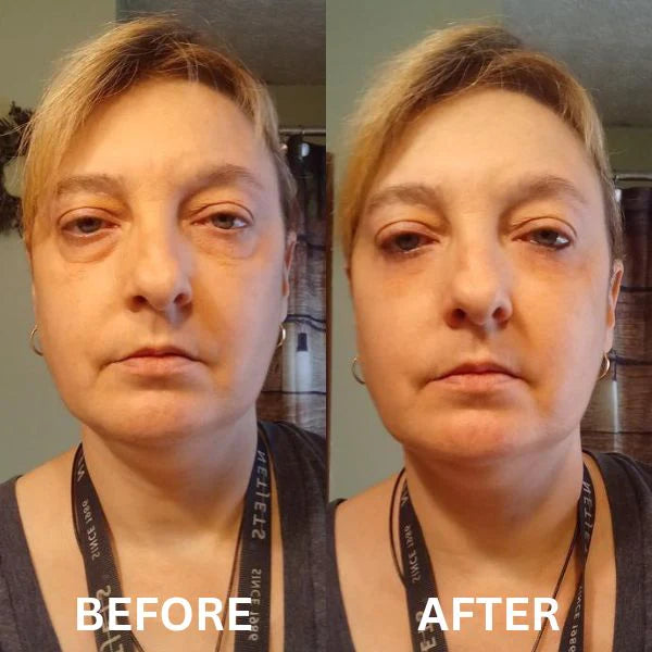 Revea™ Augen-Glow