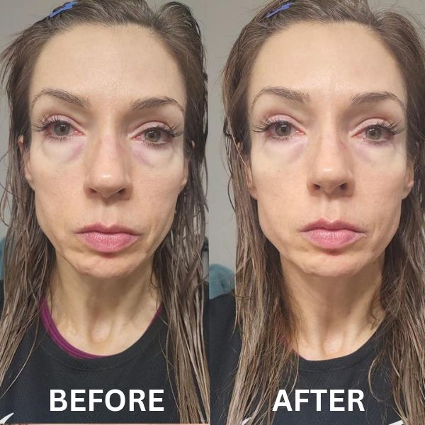 Revea™ Augen-Glow