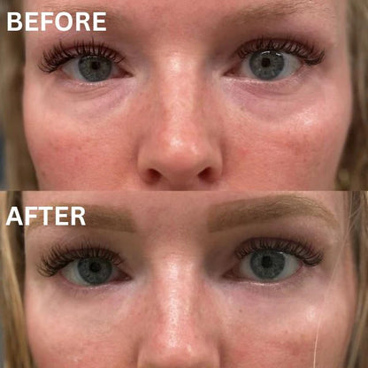 Revea™ Augen-Glow