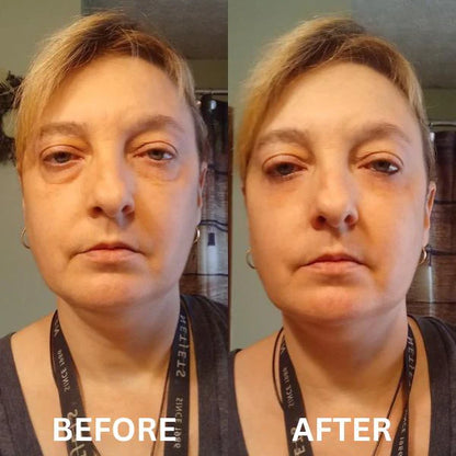 Revea™ Augen-Glow
