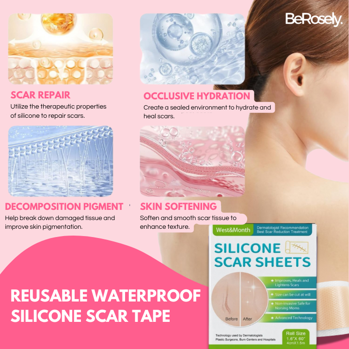 Berosely Pure Scar Tape