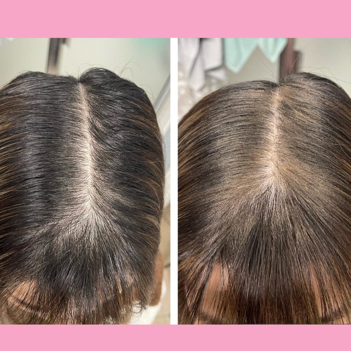 HairBlend™