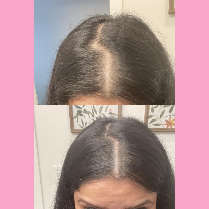 HairBlend™