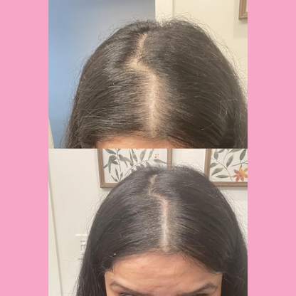 HairBlend™