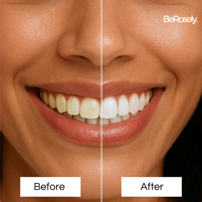 GlowSmile™
