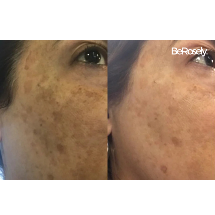 GlowPeel™ | Radiant & Hydrated Skin