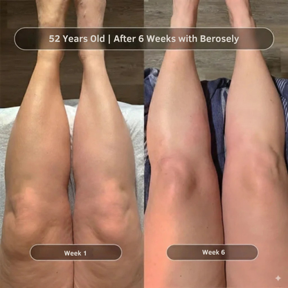 Anti-Cellulite Massage Oil