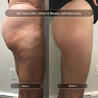 Anti-Cellulite Massage Oil