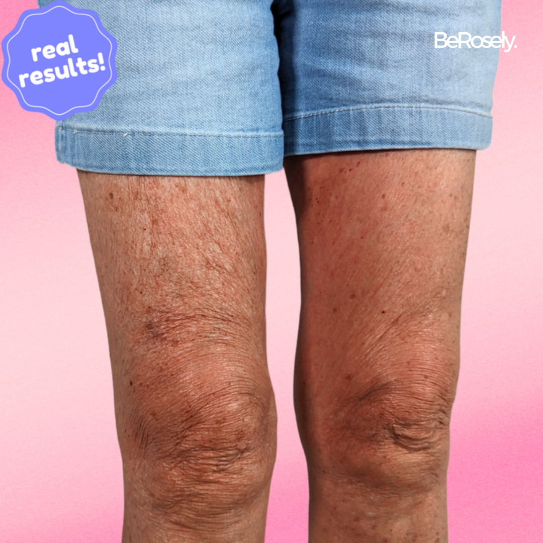 Instant Lift & Glow – Invisible Firming Patches